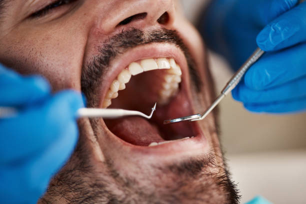 Best Urgent Tooth Repair  in Beverly, NJ